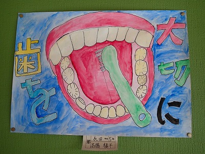 「歯と口の健康啓発ポスター」学校代表作品掲示
