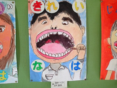 「歯と口の健康啓発ポスター」学校代表作品掲示